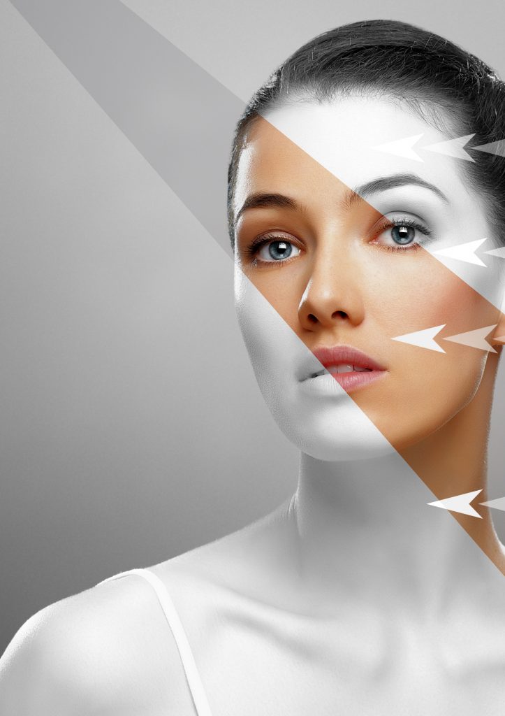 Fusion Meso nanoneulaus.  Kauniin naisen kuva, jossa osoitetaan nuolilla, mitä kohtia erityisesti haluataan kasvoissa hoitaa. Otsa, silmänympärysiho, posket, leuka ja kaula.